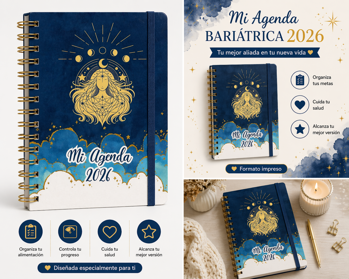 Agenda Bariátrica 2026- Modelo Celestial